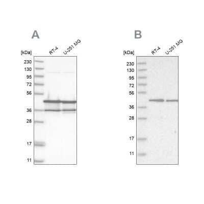 Western Blot: NUDC Antibody [NBP1-89517]