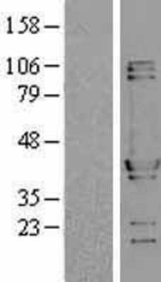 Western Blot: NUDC Overexpression Lysate [NBL1-13850]