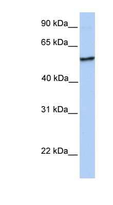 Western Blot: NUDCD1 Antibody [NBP1-55000]