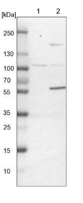 Western Blot: NUDCD1 Antibody [NBP1-85539]