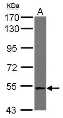 Western Blot: NUDCD1 Antibody [NBP2-19605]