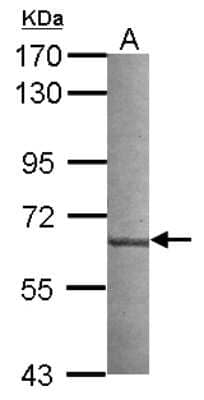 Western Blot: NUDCD1 Antibody [NBP2-19606]