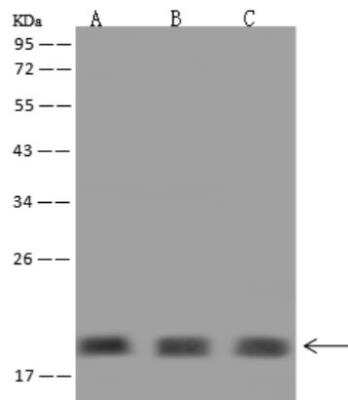 Western Blot: NUDCD2 Antibody [NBP3-06434]