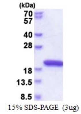 SDS-PAGE: Recombinant Human NUDCD2 His Protein [NBP2-51592]