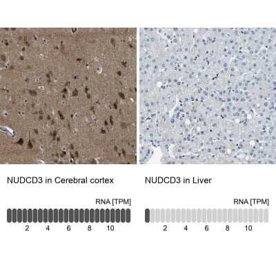 Immunohistochemistry-Paraffin: NUDCD3 Antibody [NBP1-82938]