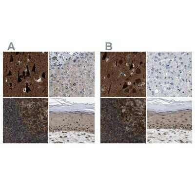 Immunohistochemistry-Paraffin: NUDCD3 Antibody [NBP1-82940]