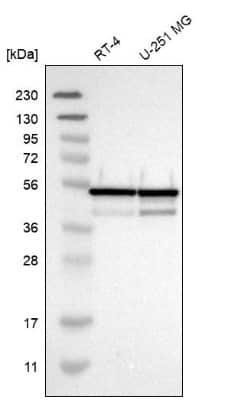 Western Blot: NUDCD3 Antibody [NBP1-82939]