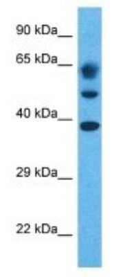 Western Blot: NUDCD3 Antibody [NBP3-09934]