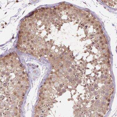 Immunohistochemistry-Paraffin: NUDT10 Antibody [NBP2-59762]