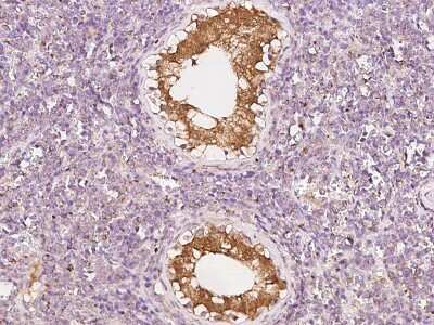 Immunohistochemistry-Paraffin: NUDT10 Antibody [NBP2-97464]