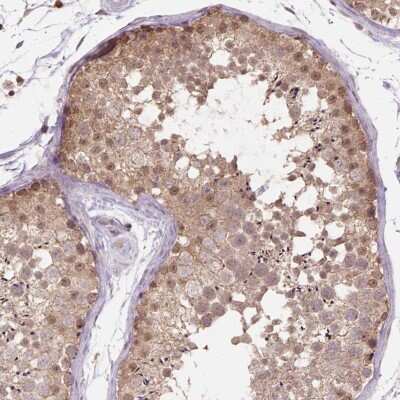 Immunohistochemistry: NUDT11 Antibody [NBP2-49265]