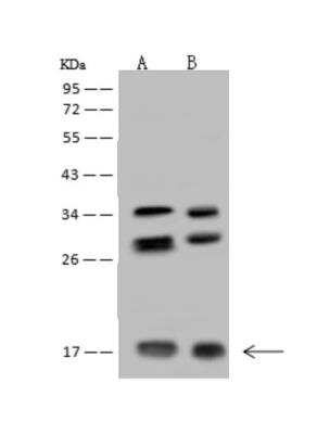 Western Blot: NUDT11 Antibody [NBP3-06300]