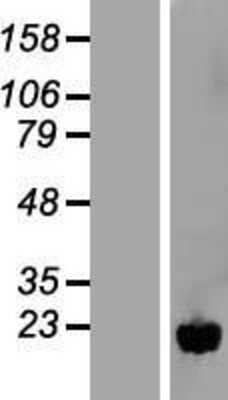 Western Blot: NUDT11 Overexpression Lysate [NBL1-13854]