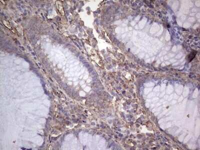 Immunohistochemistry: NUDT12 Antibody (OTI2G2) [NBP2-46275]