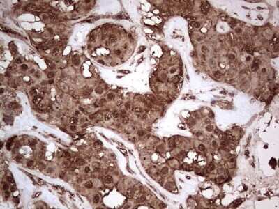 Immunohistochemistry: NUDT12 Antibody (OTI2G2) [NBP2-46275]