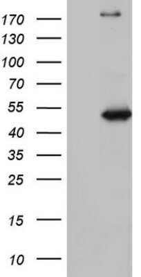 Western Blot: NUDT12 Antibody (OTI2G2) [NBP2-46275]