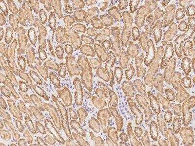 Immunohistochemistry-Paraffin: NUDT12 Antibody [NBP3-06025]