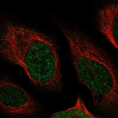 Immunocytochemistry/ Immunofluorescence: NUDT13 Antibody [NBP1-92207]