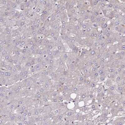 Immunohistochemistry-Paraffin: NUDT14 Antibody [NBP1-92208]