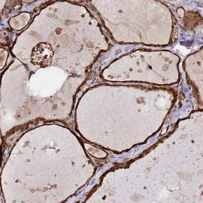 Immunohistochemistry-Paraffin: NUDT14 Antibody [NBP1-92208]