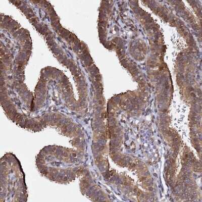 Immunohistochemistry-Paraffin: NUDT14 Antibody [NBP1-92208]