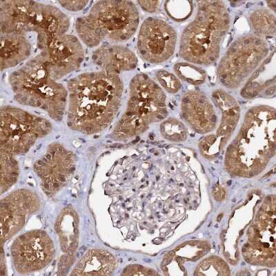 Immunohistochemistry-Paraffin: NUDT14 Antibody [NBP1-92208]