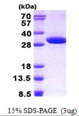 SDS-PAGE: Recombinant Human NUDT14 His Protein [NBP2-23303]