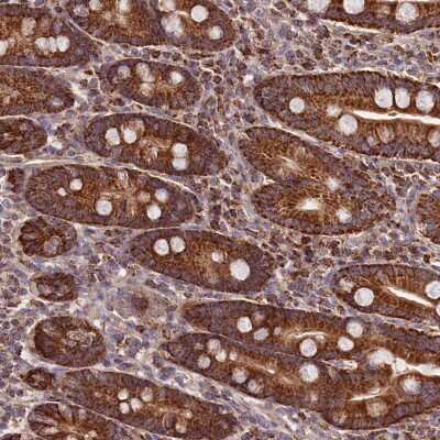 Immunohistochemistry: NUDT15 Antibody [NBP2-38436]
