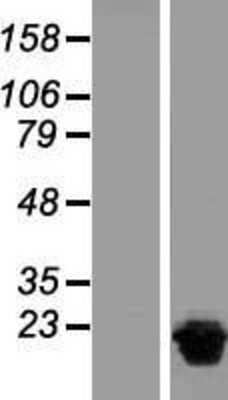 Western Blot: NUDT15 Overexpression Lysate [NBL1-13856]