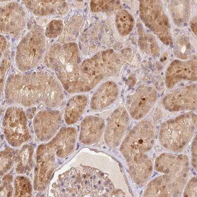 Immunohistochemistry: NUDT16 Antibody [NBP2-37992]