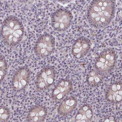 Immunohistochemistry-Paraffin: NUDT16 Antibody [NBP2-37976]