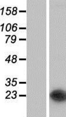 Western Blot: NUDT16 Overexpression Lysate [NBP2-05376]