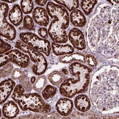 Immunohistochemistry: NUDT16L1 Antibody [NBP2-49400]