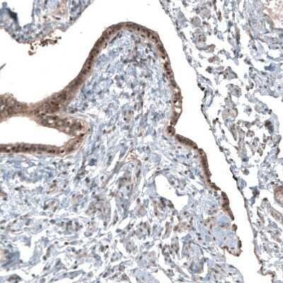 Immunohistochemistry-Paraffin: NUDT16L1 Antibody [NBP1-92209]