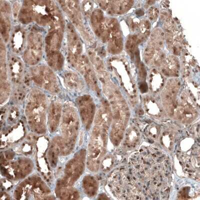 Immunohistochemistry-Paraffin: NUDT16L1 Antibody [NBP1-92209]