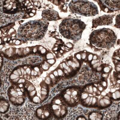 Immunohistochemistry-Paraffin: NUDT16L1 Antibody [NBP1-92209]