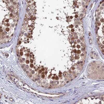 Immunohistochemistry-Paraffin: NUDT16L1 Antibody [NBP1-92209]
