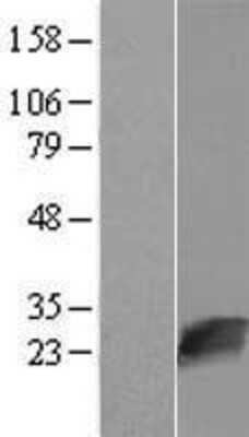 Western Blot: NUDT16L1 Overexpression Lysate [NBL1-13857]