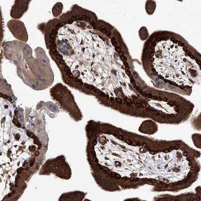 Immunohistochemistry-Paraffin: NUDT17 Antibody [NBP1-93842]