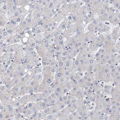 Immunohistochemistry-Paraffin: NUDT17 Antibody [NBP1-93842]