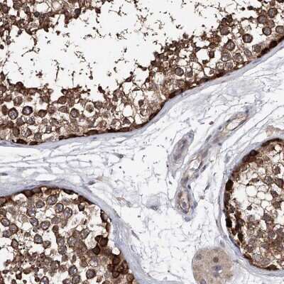 Immunohistochemistry-Paraffin: NUDT17 Antibody [NBP1-93842]