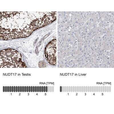 Immunohistochemistry-Paraffin: NUDT17 Antibody [NBP1-93842]
