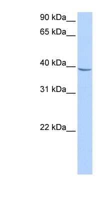 Western Blot: NUDT17 Antibody [NBP1-91325]