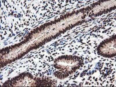 Immunohistochemistry-Paraffin: NUDT18 Antibody (OTI5D7) [NBP2-01432]