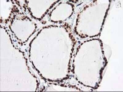 Immunohistochemistry-Paraffin: NUDT18 Antibody (OTI5D7) [NBP2-01432]