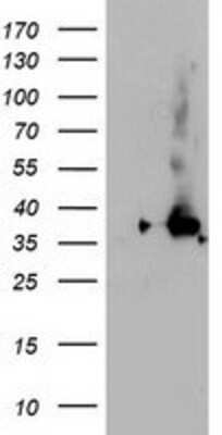 Western Blot: NUDT18 Antibody (OTI5D7) [NBP2-01432]