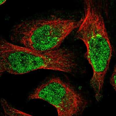 Immunocytochemistry/ Immunofluorescence: NUDT18 Antibody [NBP2-56146]