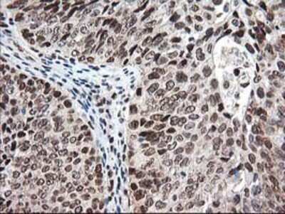 Immunohistochemistry: NUDT18 Antibody (OTI5D7) - Azide and BSA Free [NBP2-73110]