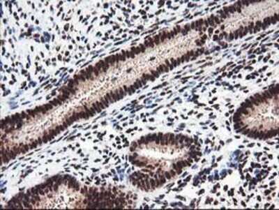 Immunohistochemistry: NUDT18 Antibody (OTI5D7) - Azide and BSA Free [NBP2-73110]