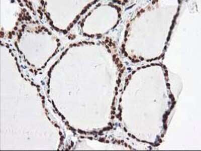 Immunohistochemistry: NUDT18 Antibody (OTI5D7) - Azide and BSA Free [NBP2-73110]
